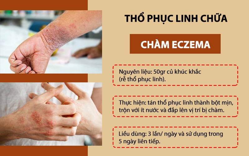 Thổ phục linh chữa chàm eczema
